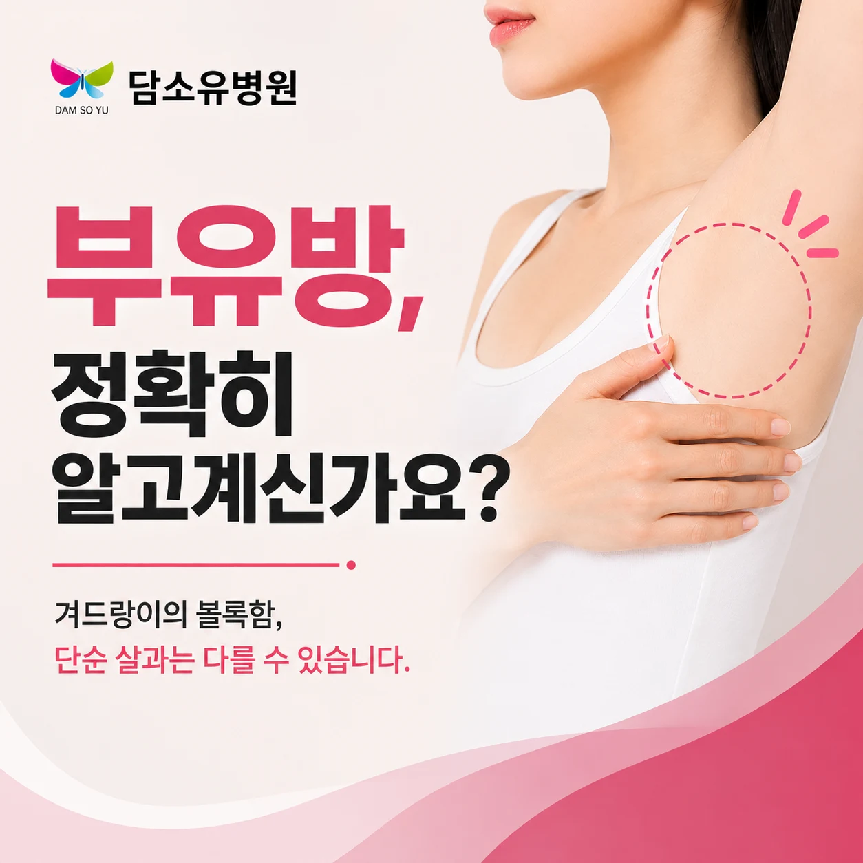 겨드랑이가 볼록하면 모두 부유방일까요?